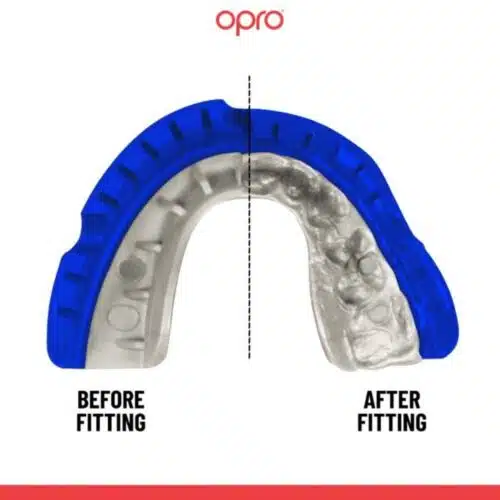 Opro gebitsbeschermer gold beugel ultra fit
