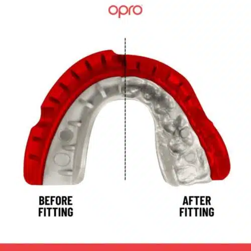 Opro gebitsbeschermer gold beugel ultra fit