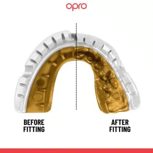Opro gebitsbeschermer gold beugel ultra fit