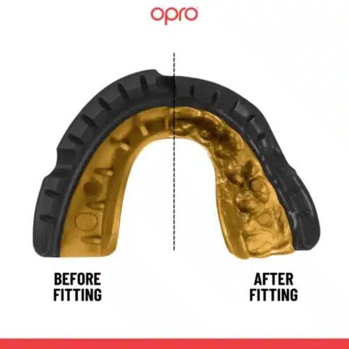Opro gebitsbeschermer gold beugel ultra fit