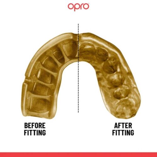 Opro gebitsbeschermer gold