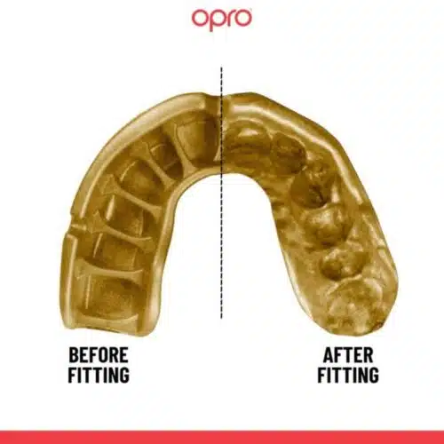 Opro gebitsbeschermer gold